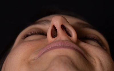 Deviated nasal septum-related sinusitis 