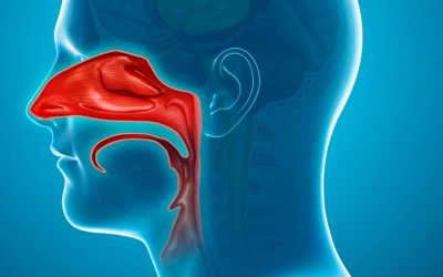 Nasal polyps